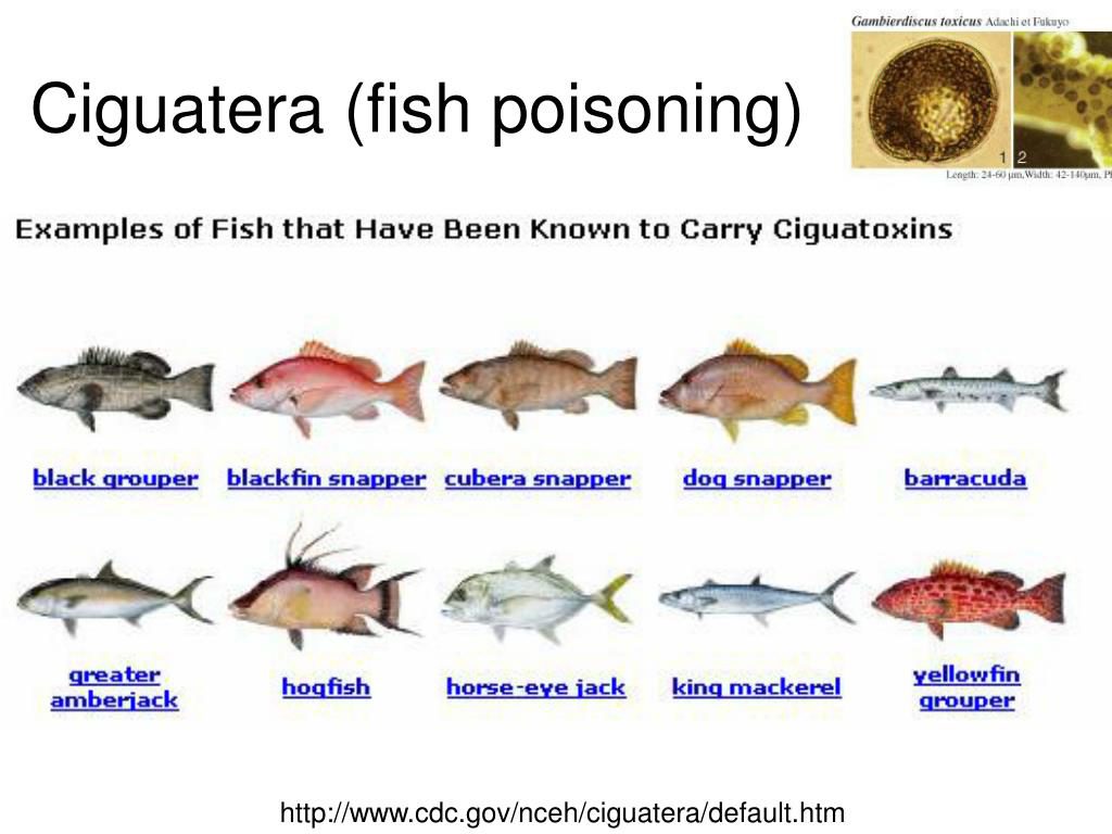 Fish Poisoning
