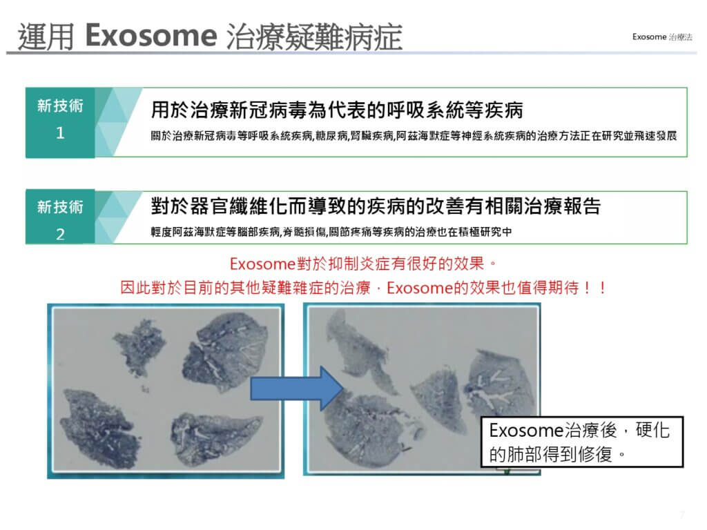 運用 Exosome 治療疑難病症