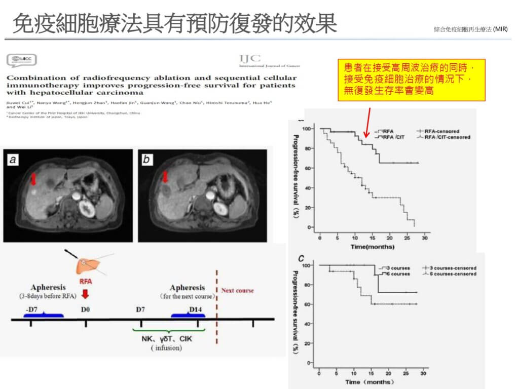 免疫細胞療法具有預防復發的效果