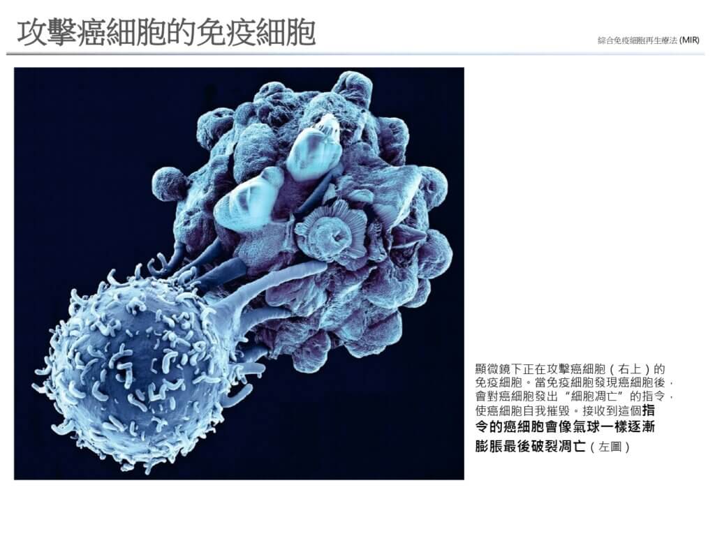 攻擊癌細胞的免疫細胞