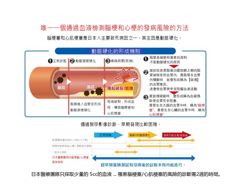 唯一一個通過血液檢測腦梗塞（中風）和心肌梗塞發病風險的方法